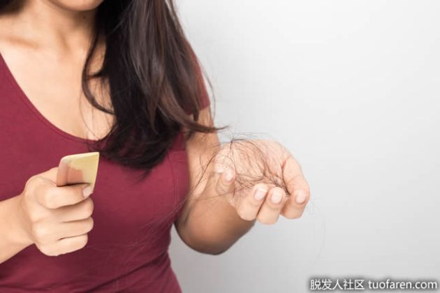 【圖】女性型脱髮的治療