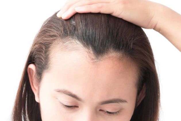 【圖】與脱髮做鬥爭的5件簡單的事情