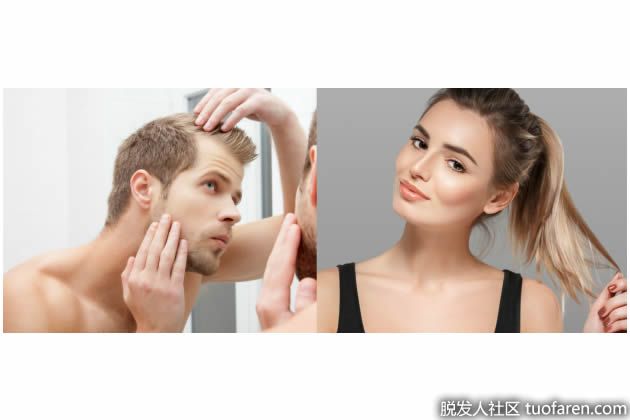 【圖】逆轉脱髮的5個秘密