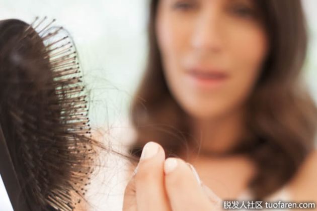 【圖】男性和女性脱髮的情況會自行恢復嗎？