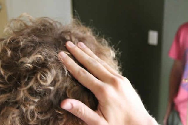 【圖】頭髮稀疏最好的維生素補充劑