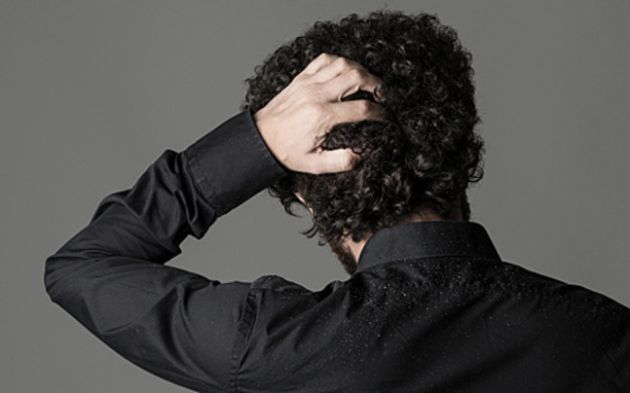 【圖】頭皮屑不好的常見原因是什麼?