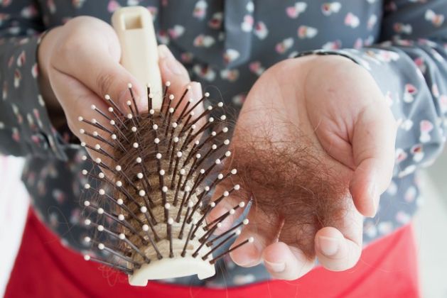 【圖】兩側頭髮稀疏的原因是什麼?