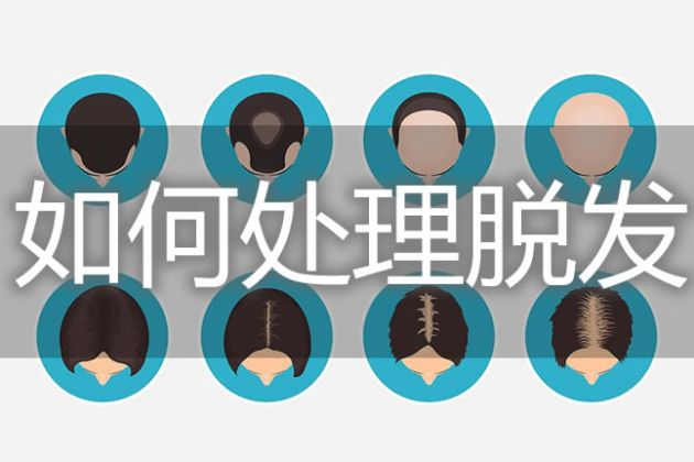 【圖】如何處理脱髮