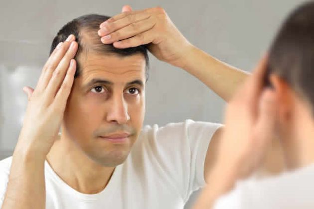 【圖】脱髮和修復的基礎知識