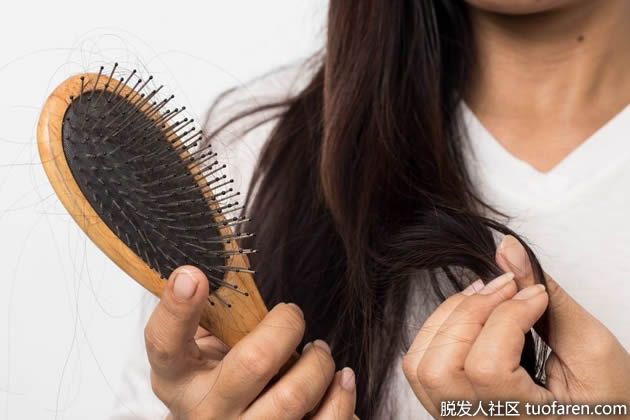 【圖】你有遺傳性脱髮嗎？