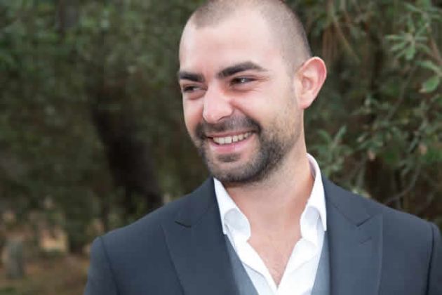 【圖】什麼會導致男人面部脱髮？