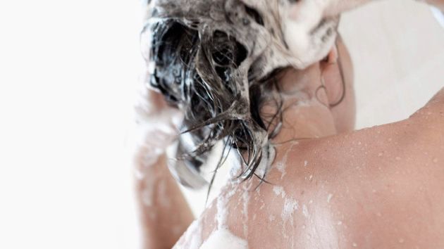 【圖】在家治療脱髮