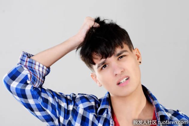 【圖】年輕人脱髮 到底是什麼原因？
