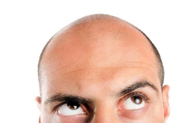 【圖】為什麼每個人都想阻止脱髮