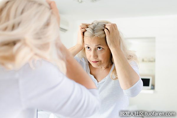 【圖】更年期脱髮：更年期脱髮的5點原因
