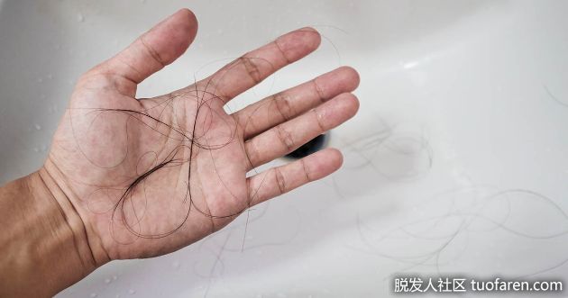 【圖】男性脱髮如何影響自尊