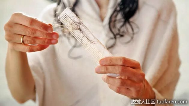 【圖】休止期脱髮會引起頭皮發癢嗎？