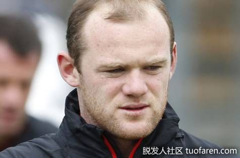 【圖】6種有效的治療髮際線後移的方法