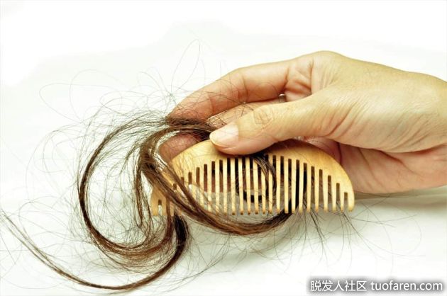 【圖】休止期脱髮的5種有效療法