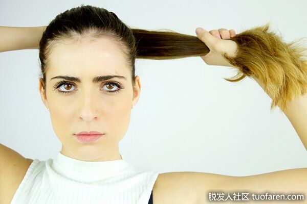 【圖】永久牽引性脱髮的跡象
