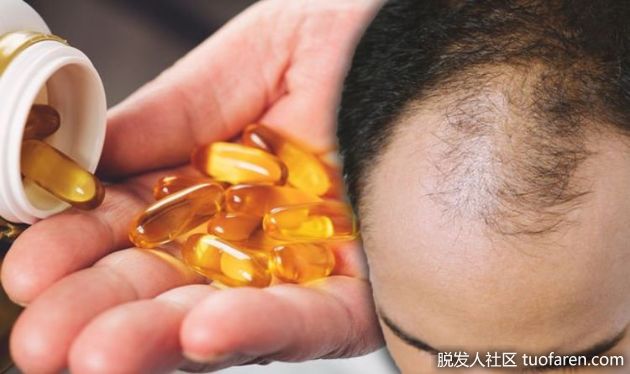 【圖】維生素D和脱髮有關係嗎？