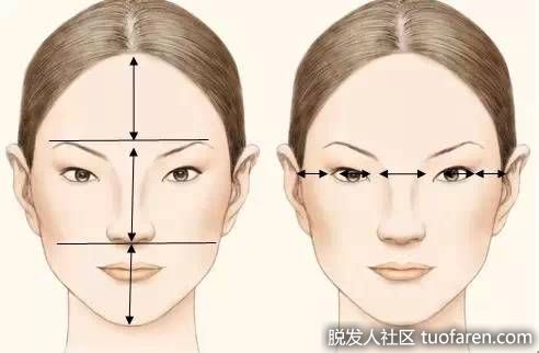 【圖】什麼是正常髮際線？