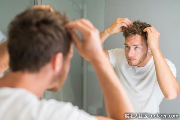 【圖】男人防止脱髮的5種方法
