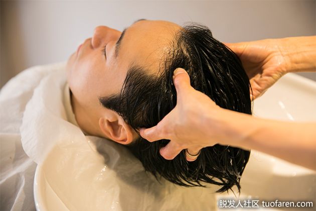 【圖】預防頭頂毛髮稀疏的5個對策