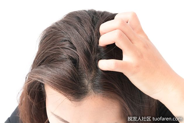 【圖】什麼是季節引起的頭皮問題？