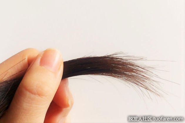 【圖】賴氨酸對頭髮的影響和攝取方法