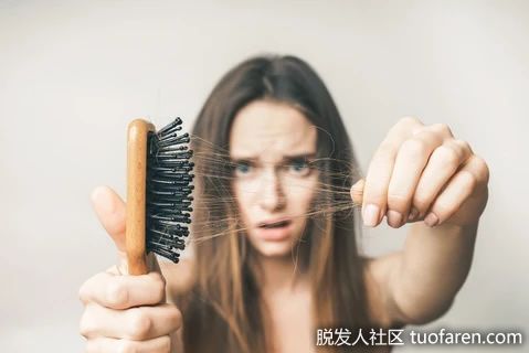 【圖】為什麼我們會脱髮？