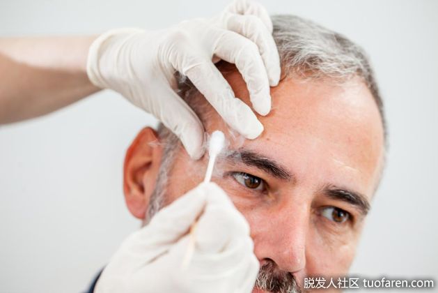 【圖】茶樹油能去除老年斑嗎？