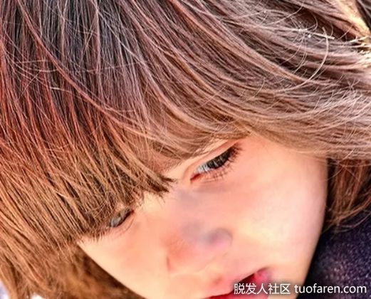 【圖】如何讓頭髮長得更快一點