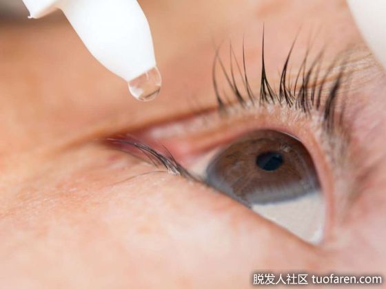 【圖】為什麼我的睫毛會痛？