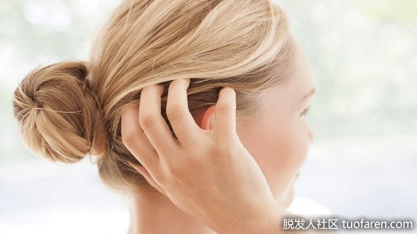 【圖】如何減少頭皮瘙癢