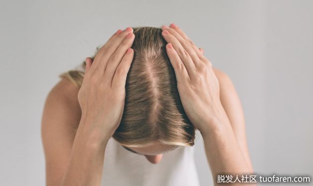 【圖】如何讓頭皮頭髮自然生長