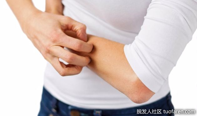 【圖】維生素D攝入過多會導致皮膚髮癢