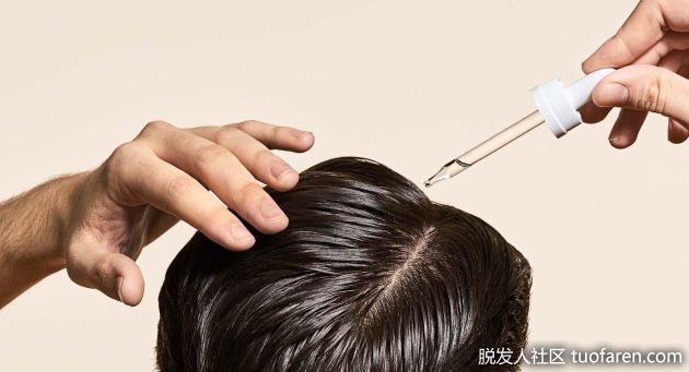 【圖】碧蓮盛植髮：米諾地爾3種形態有何區別？ 