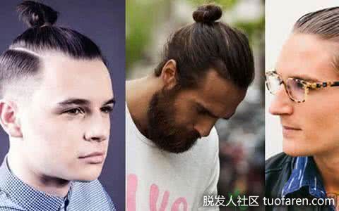 【圖】什麼是牽引性脱髮？