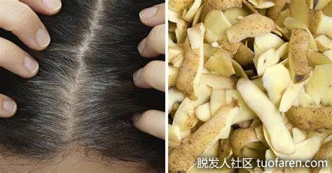 【圖】土豆對頭髮和頭皮的美容益處