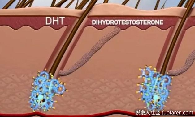 【圖】什麼是二氫睾酮DHT？