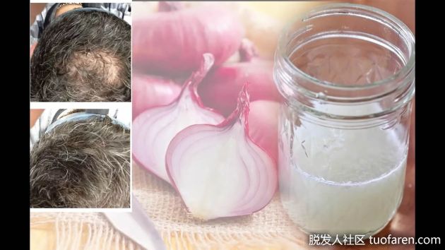 【圖】洋葱汁促頭髮生長