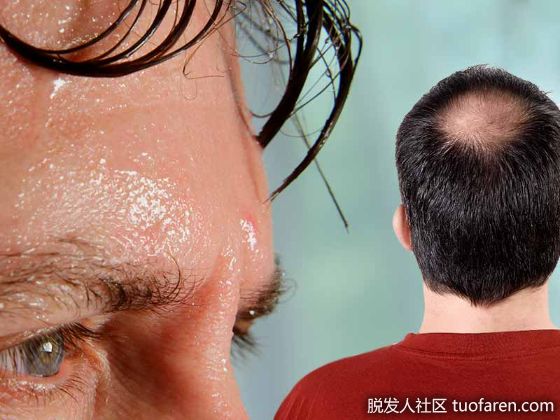 【圖】【組圖】出汗多對頭髮有影響嗎？