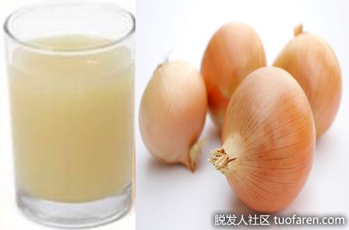 【圖】洋葱汁有效治療脱髮的原因及好處