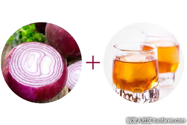 【圖】朗姆酒洋葱汁治療脱髮