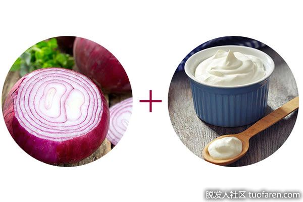 【圖】洋葱汁和酸奶抗頭皮感染