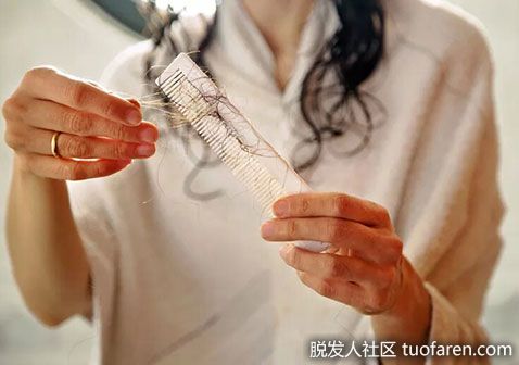 【圖】生完孩子後掉頭髮很厲害怎麼辦