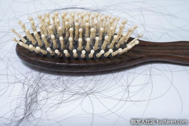 【圖】9個突然脱髮的原因