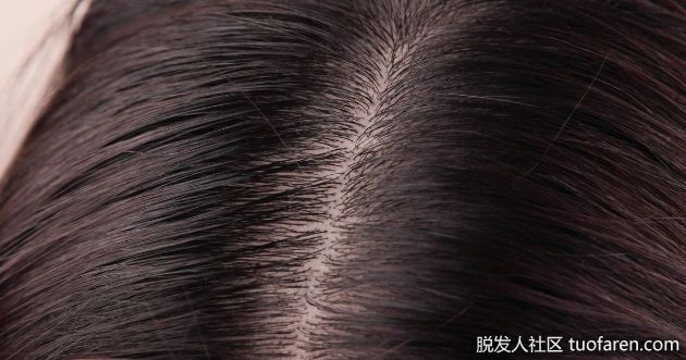 【圖】【頭髮護理】為什麼要定期為頭皮深層清潔!