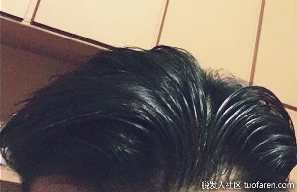 【圖】頭髮易出油原因：洗頭次數太多﹑使用護髮素不當