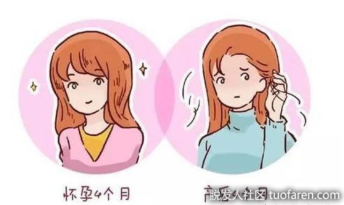 【圖】產後脱髮的3點原因