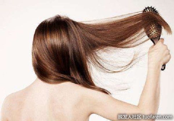 【圖】漸進脱髮常見於20至30歲 女性脱髮頭頂開始變稀疏