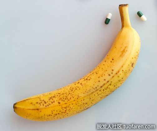 【圖】治療禿頭反不舉？醫師告訴你解方