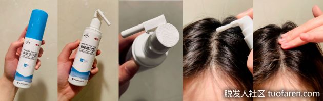 【圖】脱髮使用生髮液問題一籮筐！專科醫師破解9大常見疑慮